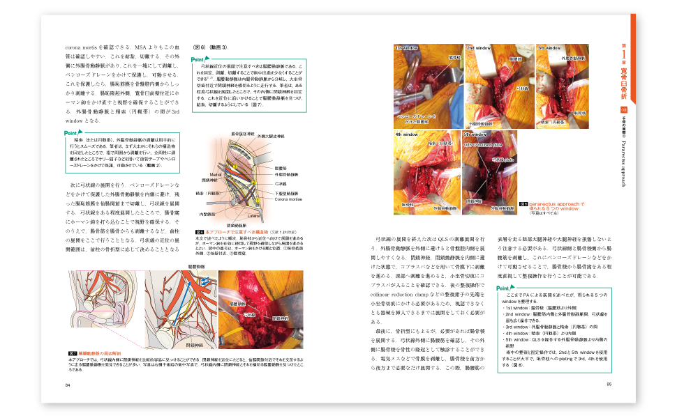 裁断本】骨盤骨折 寛骨臼骨折・骨盤輪骨折の手術手技 骨盤骨折: 寛骨臼